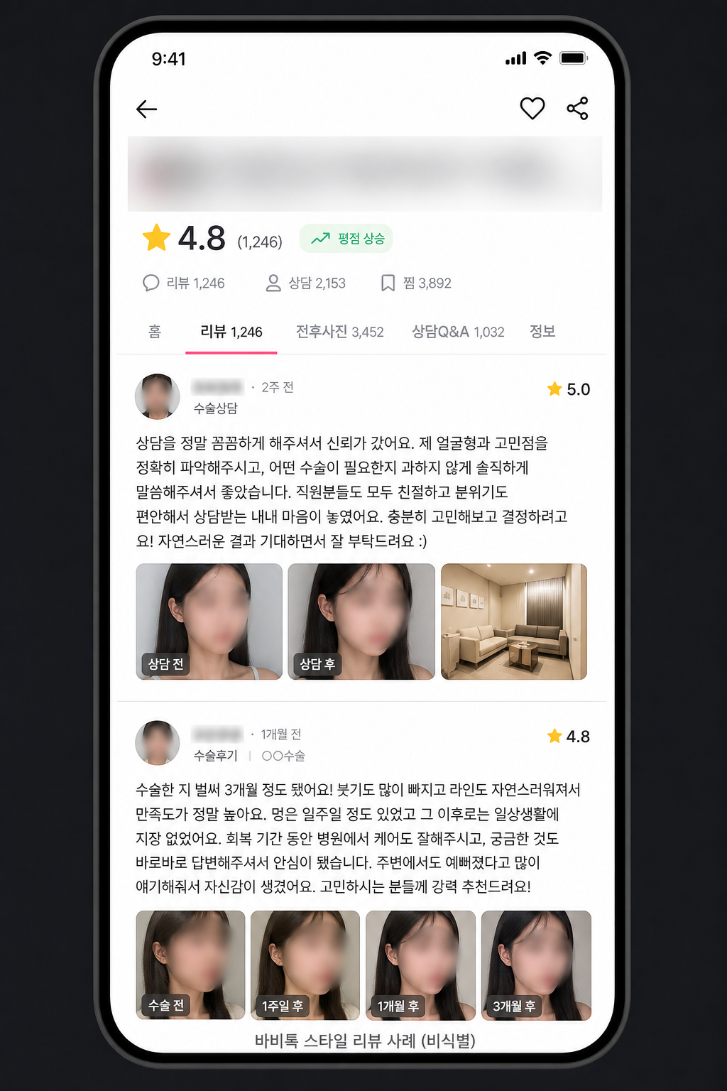 바비톡 후기 피드 사례 (비식별)