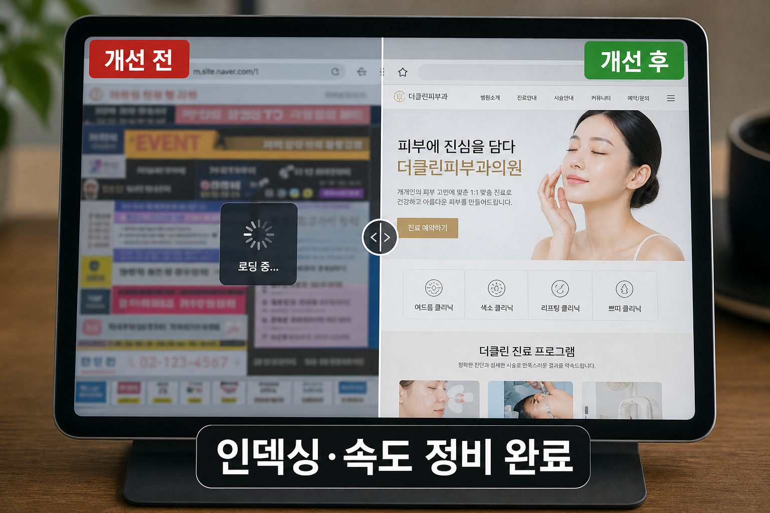테크니컬 SEO 개선 전후 인증샷
